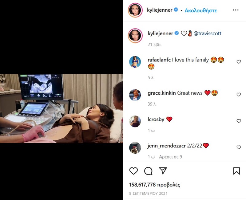Kylie Jenner