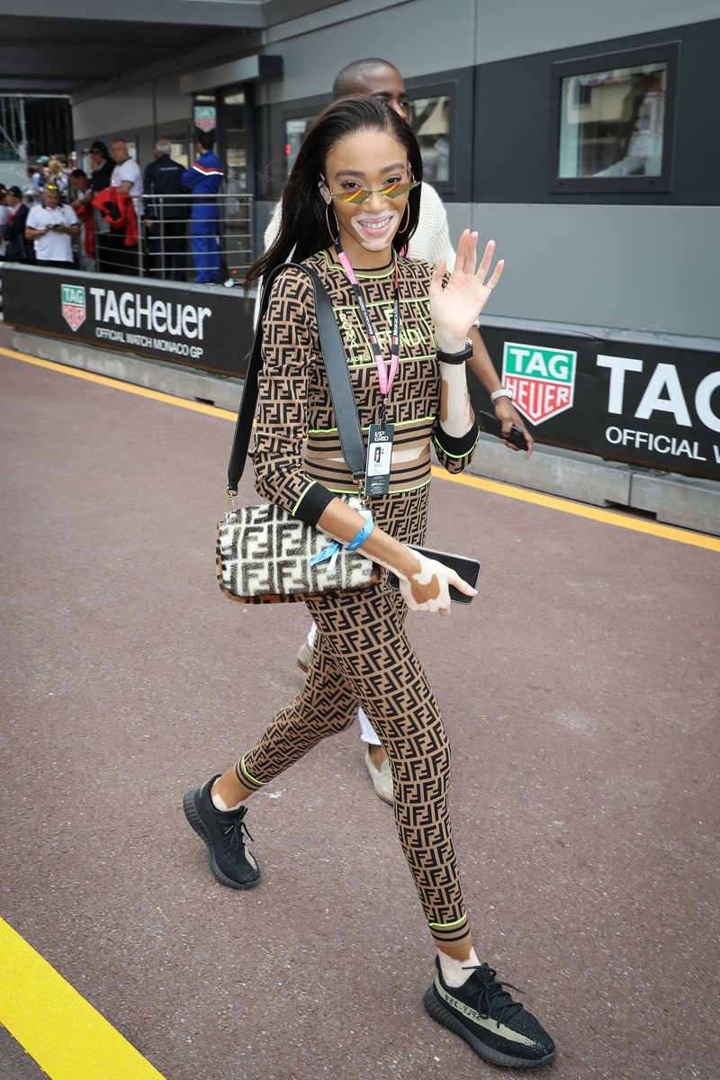 Winnie Harlow