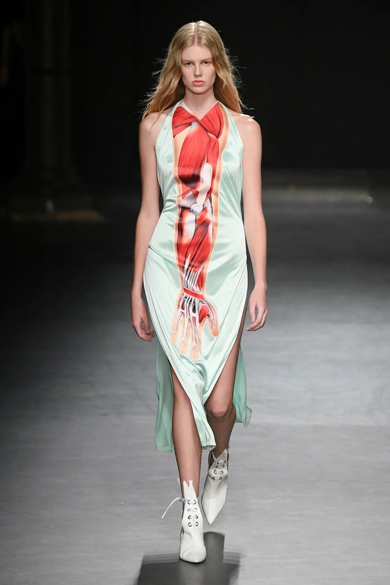 LFW