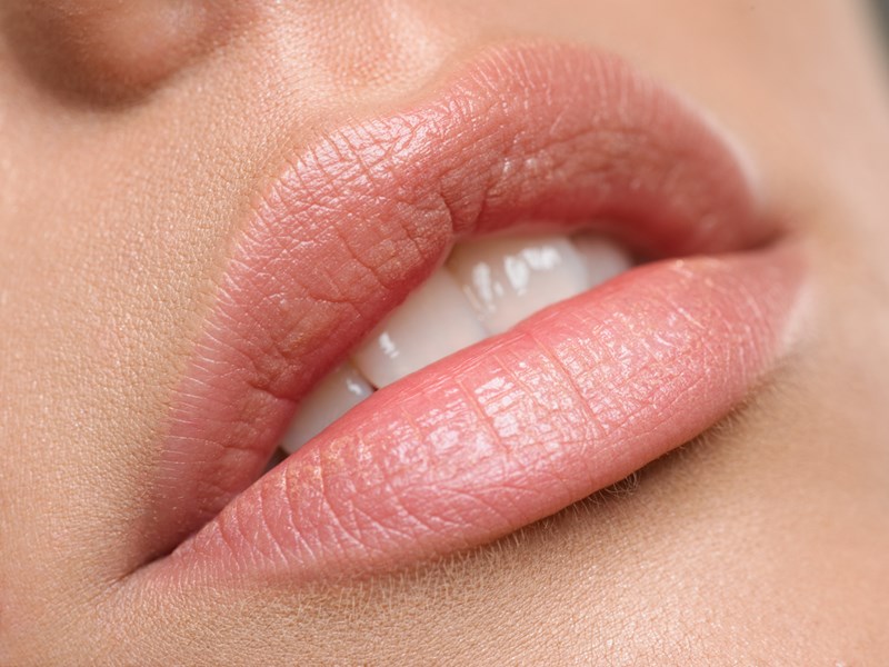 dry lips