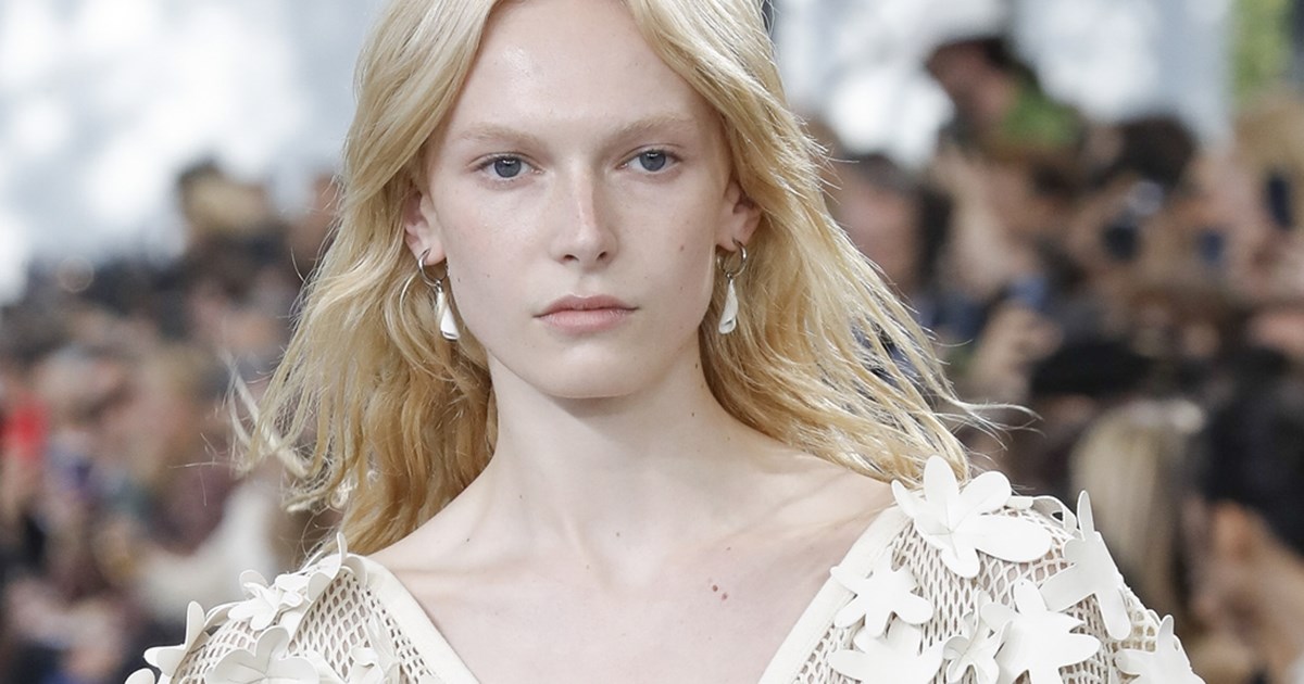 Lip fillers | Όλα όσα πρέπει να γνωρίζεις πριν πεις το "ναι" - εικόνα 1