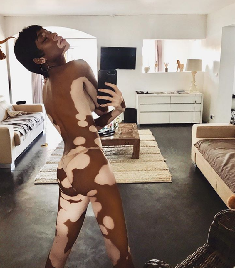winnie harlow