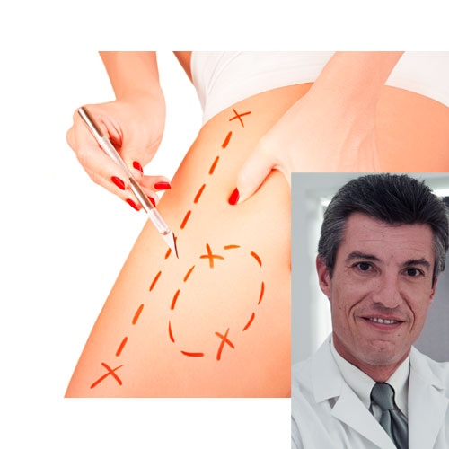 Αφιέρωμα Αισθητική: Παλλόμενη Μικροδικτυωτή Λιπογλυπτική