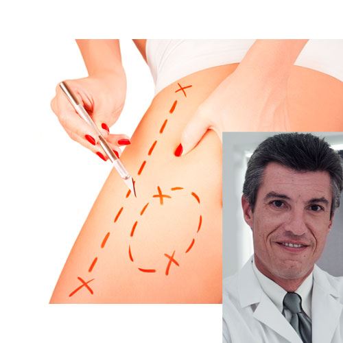 Αφιέρωμα Αισθητική: Παλλόμενη Μικροδικτυωτή Λιπογλυπτική