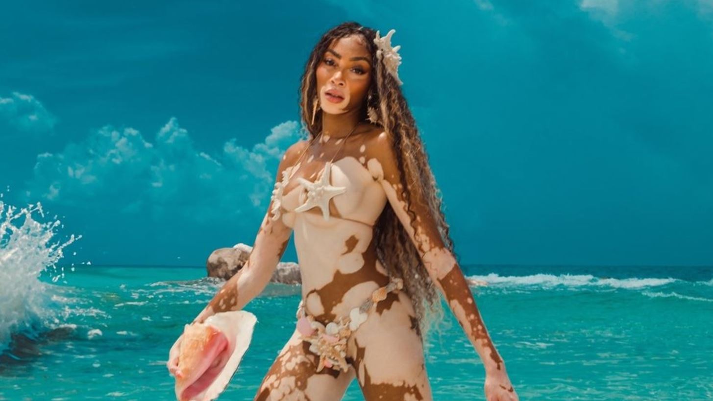 &#x397; Winnie Harlow &#x3C0;&#x3BF;&#x3B6;&#x3AC;&#x3C1;&#x3B5;&#x3B9; &#x3C3;&#x3C4;&#x3B7; &#x3BD;&#x3AD;&#x3B1; &#x3BA;&#x3B1;&#x3BC;&#x3C0;&#x3AC;&#x3BD;&#x3B9;&#x3B1; &#x3C4;&#x3BF;&#x3C5; brand &#x3C4;&#x3B7;&#x3C2; &#x3BC;&#x3B5; Celia Kritharioti &#x3BC;&#x3B1;&#x3B3;&#x3B9;&#x3CC;