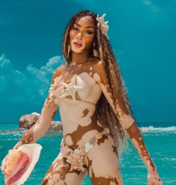 &#x397; Winnie Harlow &#x3C0;&#x3BF;&#x3B6;&#x3AC;&#x3C1;&#x3B5;&#x3B9; &#x3C3;&#x3C4;&#x3B7; &#x3BD;&#x3AD;&#x3B1; &#x3BA;&#x3B1;&#x3BC;&#x3C0;&#x3AC;&#x3BD;&#x3B9;&#x3B1; &#x3C4;&#x3BF;&#x3C5; brand &#x3C4;&#x3B7;&#x3C2; &#x3BC;&#x3B5; Celia Kritharioti &#x3BC;&#x3B1;&#x3B3;&#x3B9;&#x3CC;