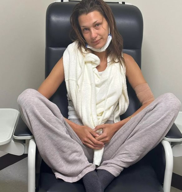 &#x397; Bella Hadid &#x3BC;&#x3BF;&#x3B9;&#x3C1;&#x3AC;&#x3B6;&#x3B5;&#x3C4;&#x3B1;&#x3B9; &#x3C6;&#x3C9;&#x3C4;&#x3BF;&#x3B3;&#x3C1;&#x3B1;&#x3C6;&#x3AF;&#x3B5;&#x3C2; &#x3B1;&#x3C0;&#x3CC; &#x3C4;&#x3B7;&#x3BD; &#x3BC;&#x3AC;&#x3C7;&#x3B7; &#x3C4;&#x3B7;&#x3C2; &#x3BC;&#x3B5; &#x3C4;&#x3B7; &#x3BD;&#x3CC;&#x3C3;&#x3BF; Lyme &#x3BA;&#x3B1;&#x3B9; &#x3C3;&#x3C4;&#x3AD;&#x3BB;&#x3BD;&#x3B5;&#x3B9; &#x3C4;&#x3BF; &#x3B4;&#x3B9;&#x3BA;&#x3CC; &#x3C4;&#x3B7;&#x3C2; &#x3B7;&#x3C7;&#x3B7;&#x3C1;&#x3CC; &#x3BC;&#x3AE;&#x3BD;&#x3C5;&#x3BC;&#x3B1;