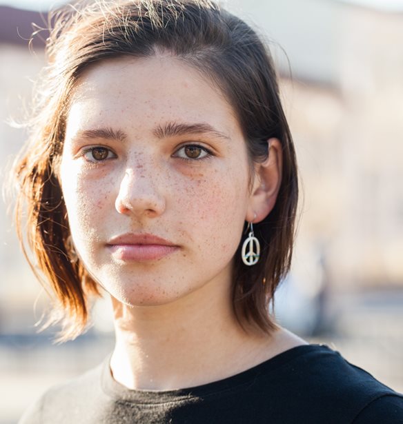 Καταπολέμησε την ακμή με "όπλο" τη διατροφή σου