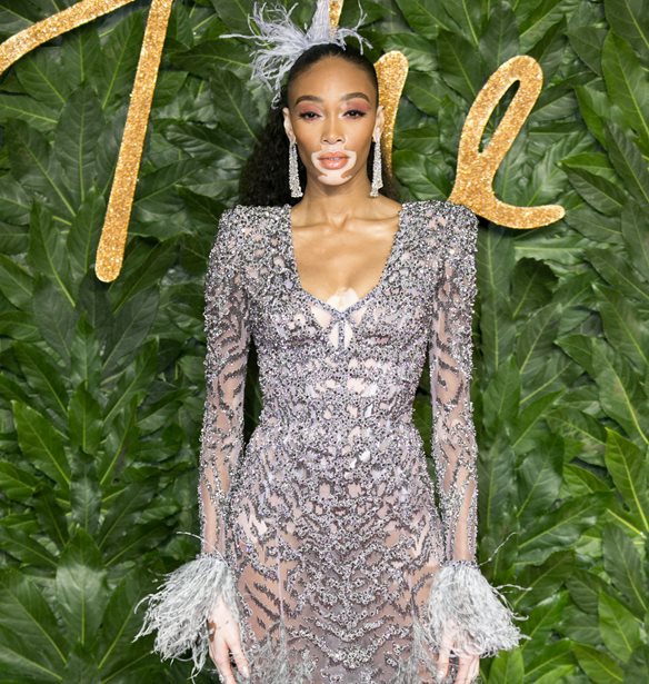 &#x397; Winnie Harlow &#x3C0;&#x3BF;&#x3B6;&#x3AC;&#x3C1;&#x3B5;&#x3B9; &#x3C3;&#x3C4;&#x3B7; &#x3BD;&#x3AD;&#x3B1; &#x3BA;&#x3B1;&#x3BC;&#x3C0;&#x3AC;&#x3BD;&#x3B9;&#x3B1; &#x3C4;&#x3BF;&#x3C5; brand &#x3C4;&#x3B7;&#x3C2; &#x3BC;&#x3B5; Celia Kritharioti &#x3BC;&#x3B1;&#x3B3;&#x3B9;&#x3CC;